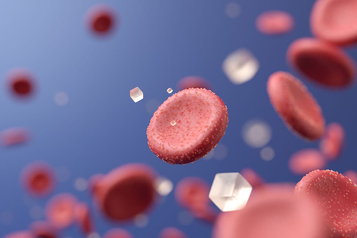 Metabolikus szindróma diagnosztika